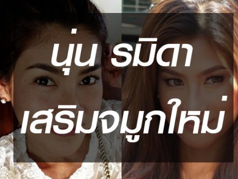 นุ่น-รมิดา-เสริมจมูก