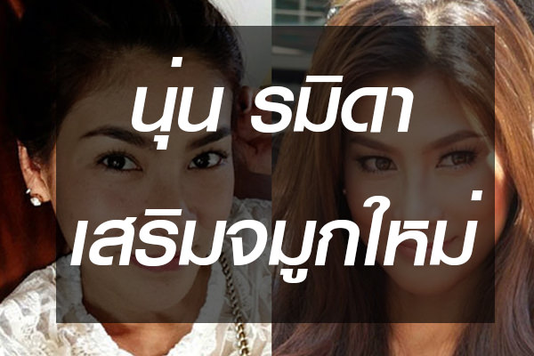 นุ่น-รมิดา-เสริมจมูก